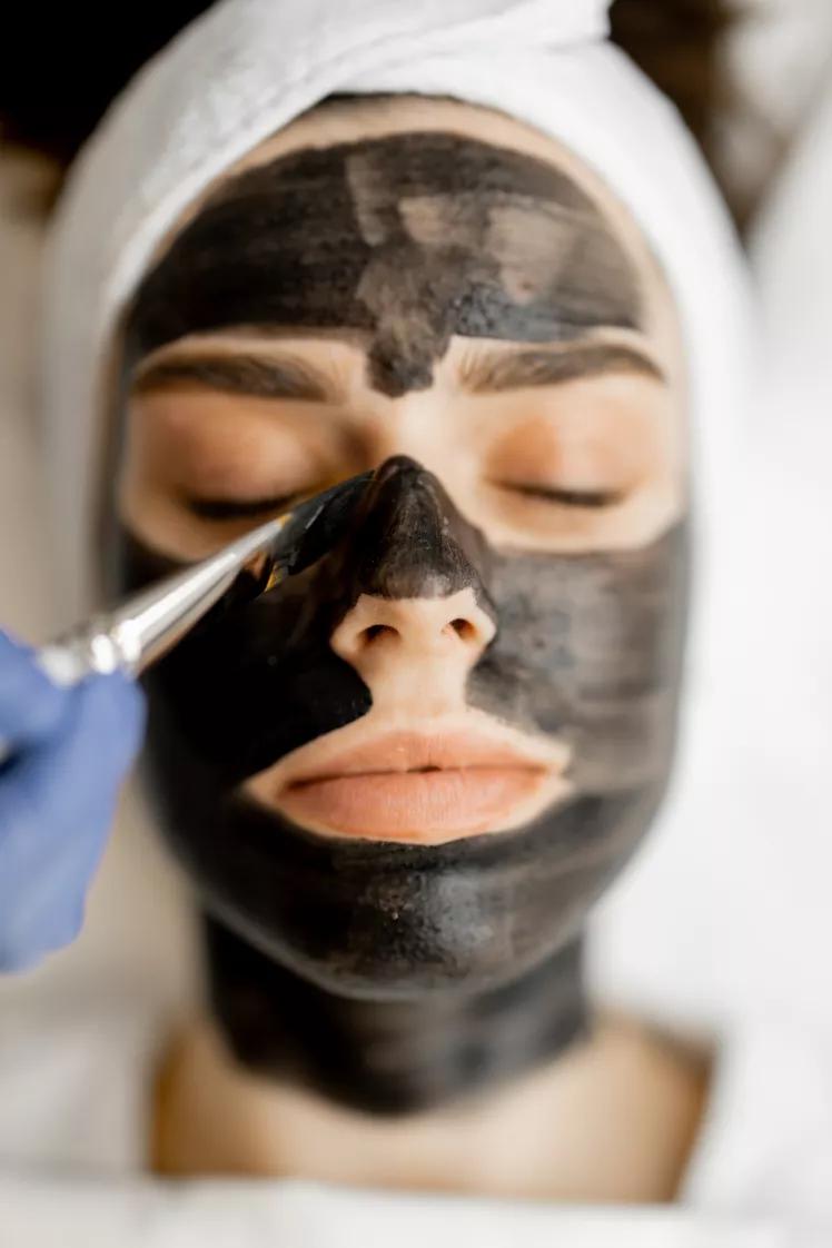 Carbon-Peeling für die Gesichtshaut