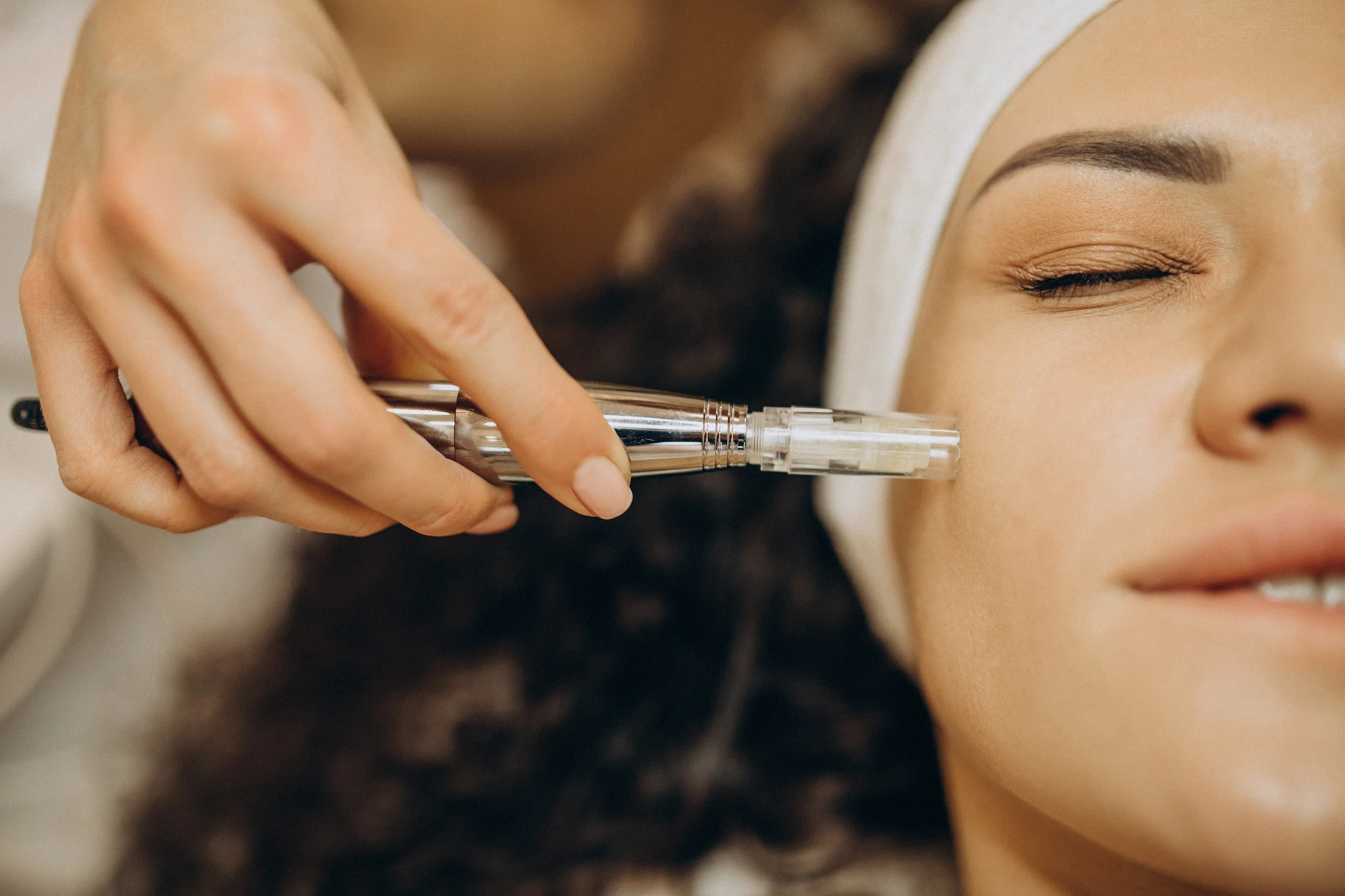 Microneedling mit Nadelstift im Kosmetikstudio